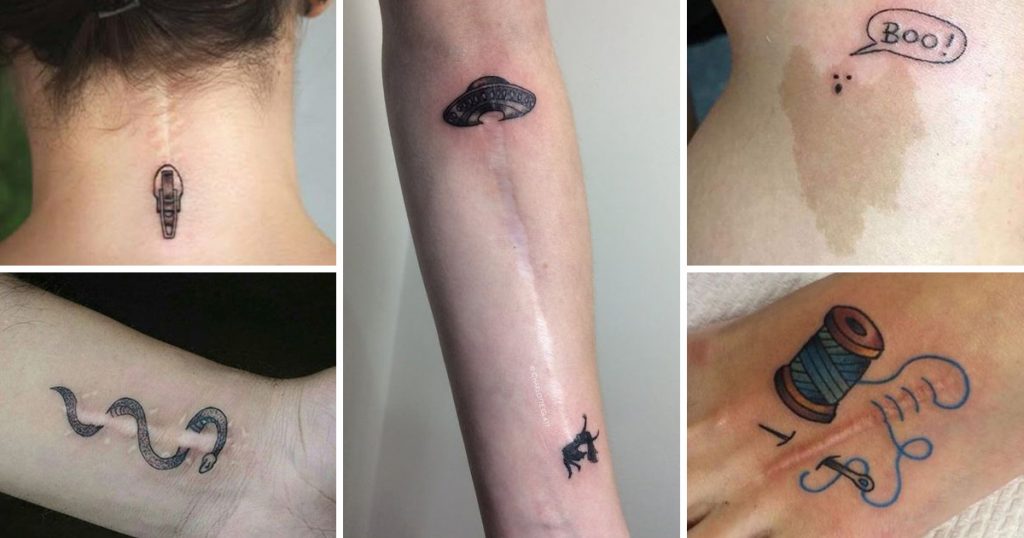 Scars & skin blemishes - tattoos